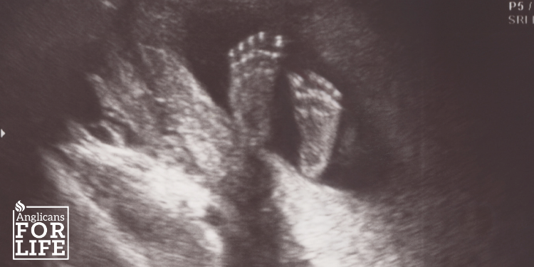 Ultrasound image of baby feet
