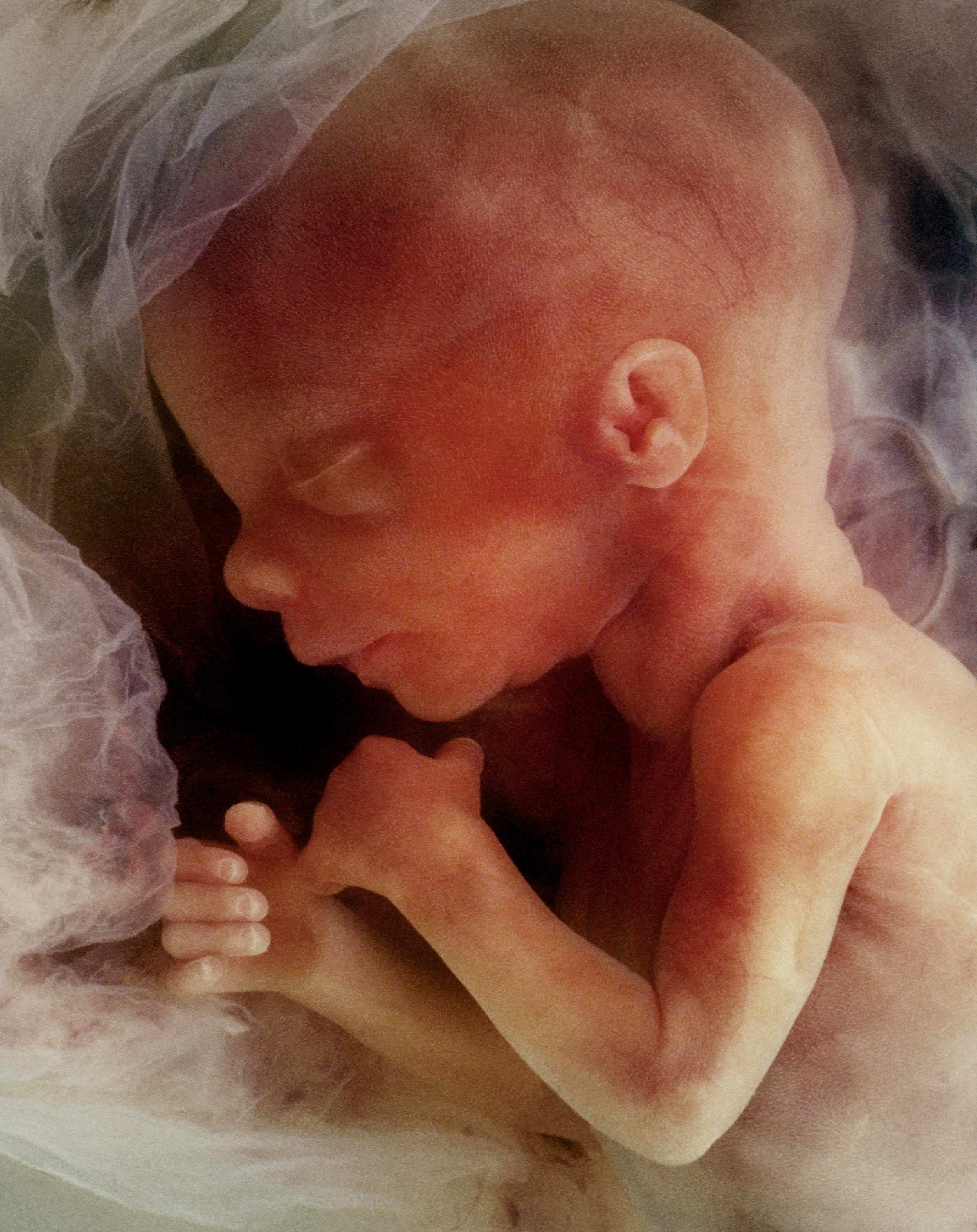 baby with arms, legs, ears, and eyes in the womb